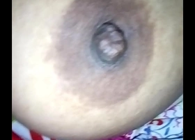 My breast